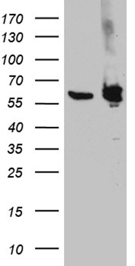 ALDH7A1 Antibody