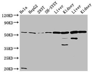 ALDH7A1 Antibody
