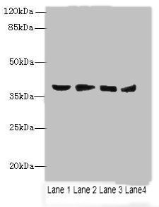 AKR1C2 Antibody