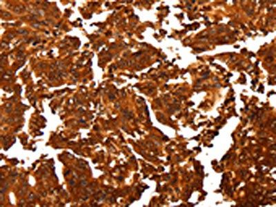 ALDOA Antibody