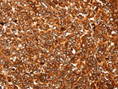 ALDOA Antibody