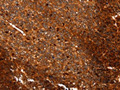 ALDOA Antibody
