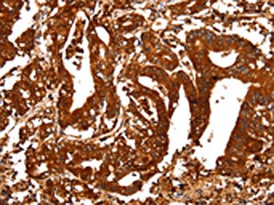 ALDOA Antibody