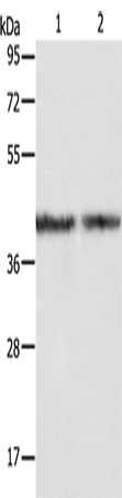 ALDOA Antibody