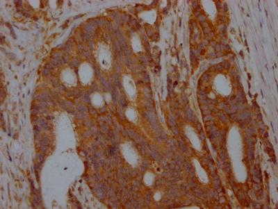 ALDOA Antibody