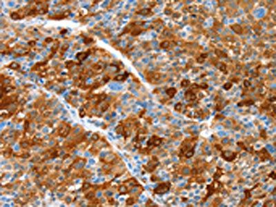 ALDOB Antibody