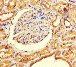 GALM Antibody