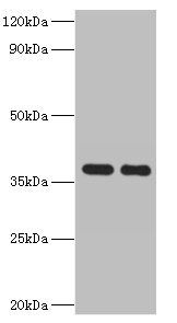 GALM Antibody