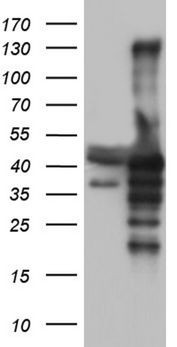 ALK Antibody