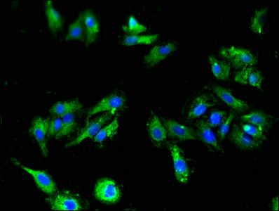 ALK Antibody