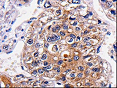 ALK Antibody