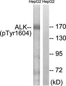 ALK (Phospho-Tyr1604) Antibody