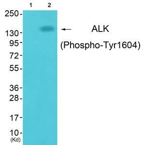 ALK (Phospho-Tyr1604) Antibody