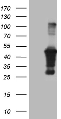 Alkaline Phosphatase Antibody