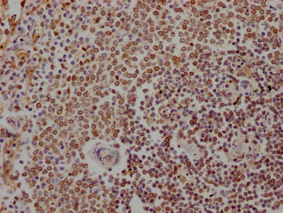 ALOX5 Antibody