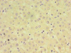 AFP Antibody