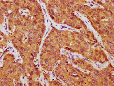 AFP Antibody