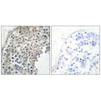 ADRA2A Antibody