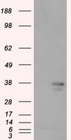 ACTN1 Antibody