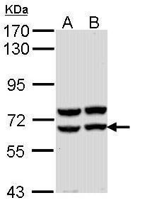 amylase alpha 2A (pancreatic) Antibody