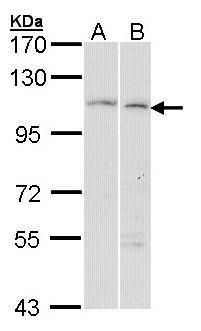 glucosidase II alpha subunit Antibody