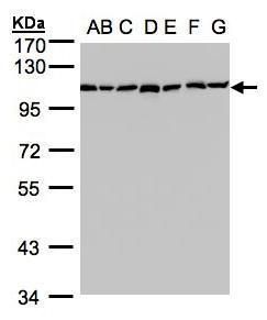 glucosidase II alpha subunit Antibody