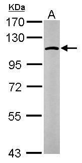 glucosidase II alpha subunit Antibody