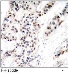 Estrogen Receptor-α (Phospho-Ser106) Antibody