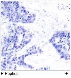 Estrogen Receptor-α (Phospho-Ser106) Antibody