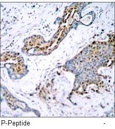 Estrogen Receptor-α (Phospho-Ser118) Antibody