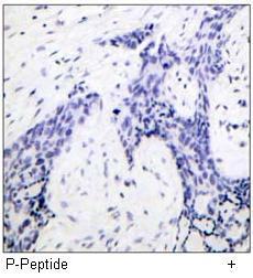 Estrogen Receptor-α (Phospho-Ser118) Antibody