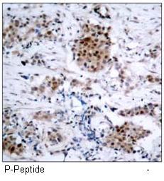Estrogen Receptor-α (Phospho-Ser167) Antibody