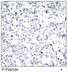 Estrogen Receptor-α (Phospho-Ser167) Antibody
