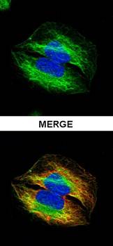 alpha Tubulin 4a Rabbit Polyclonal Antibody