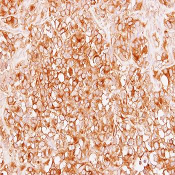 alpha Tubulin 4a Rabbit Polyclonal Antibody