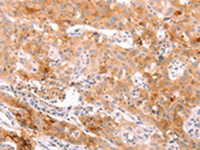 ALPPL2 Antibody