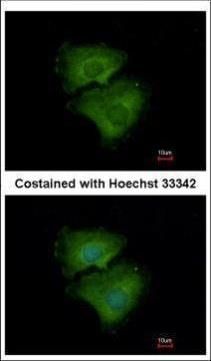 alkaline phosphatase, germ cell Antibody