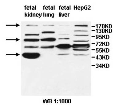 ALS2 Rabbit Polyclonal Antibody