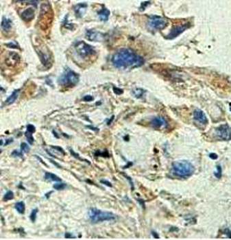 ALS2 Rabbit Polyclonal Antibody