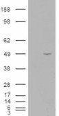 ALS2CR2/ILPIP Antibody