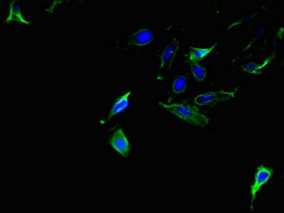 AMACR Antibody
