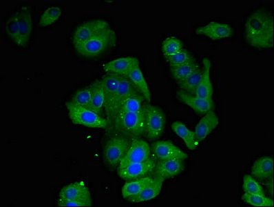 AMD1 Antibody