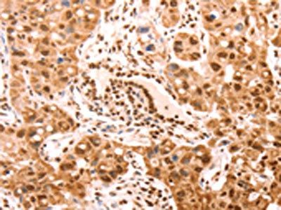 AMD1 Antibody