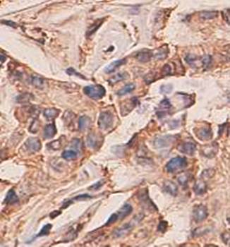 AMIGO2 Rabbit Polyclonal Antibody
