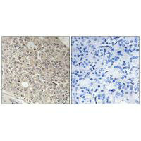 AMOTL1 Antibody