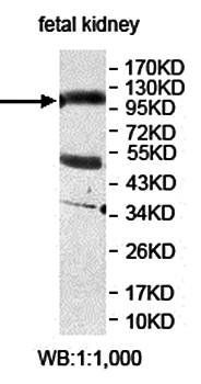 AMOTL1 Rabbit Polyclonal Antibody
