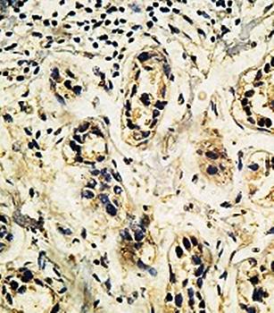 AMOTL1 Rabbit Polyclonal Antibody
