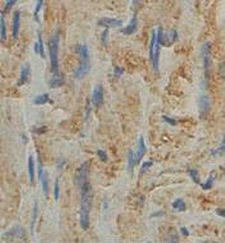 AMOTL2 Rabbit Polyclonal Antibody