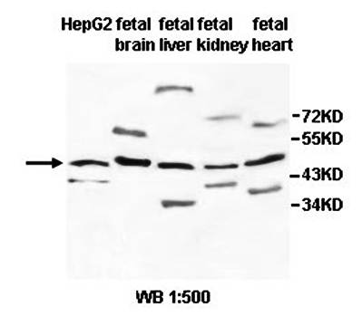 AMOTL2 Rabbit Polyclonal Antibody