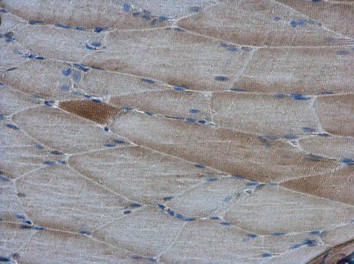 AMPK alpha 2 Rabbit Polyclonal Antibody